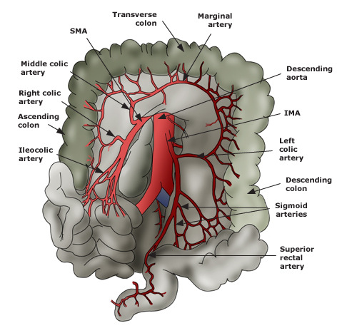 Colitis Ischemic