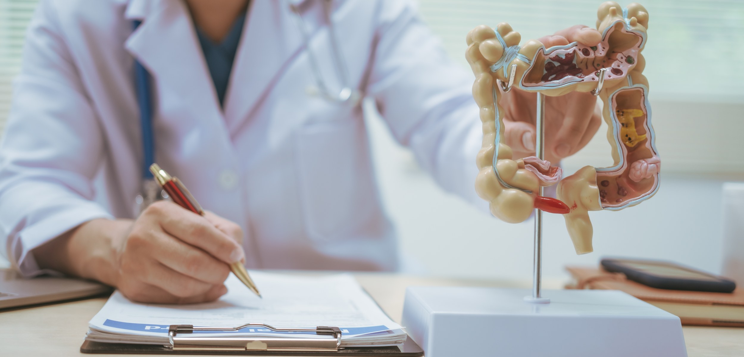 C. difficile Infection — Doctor writing notes by colon model