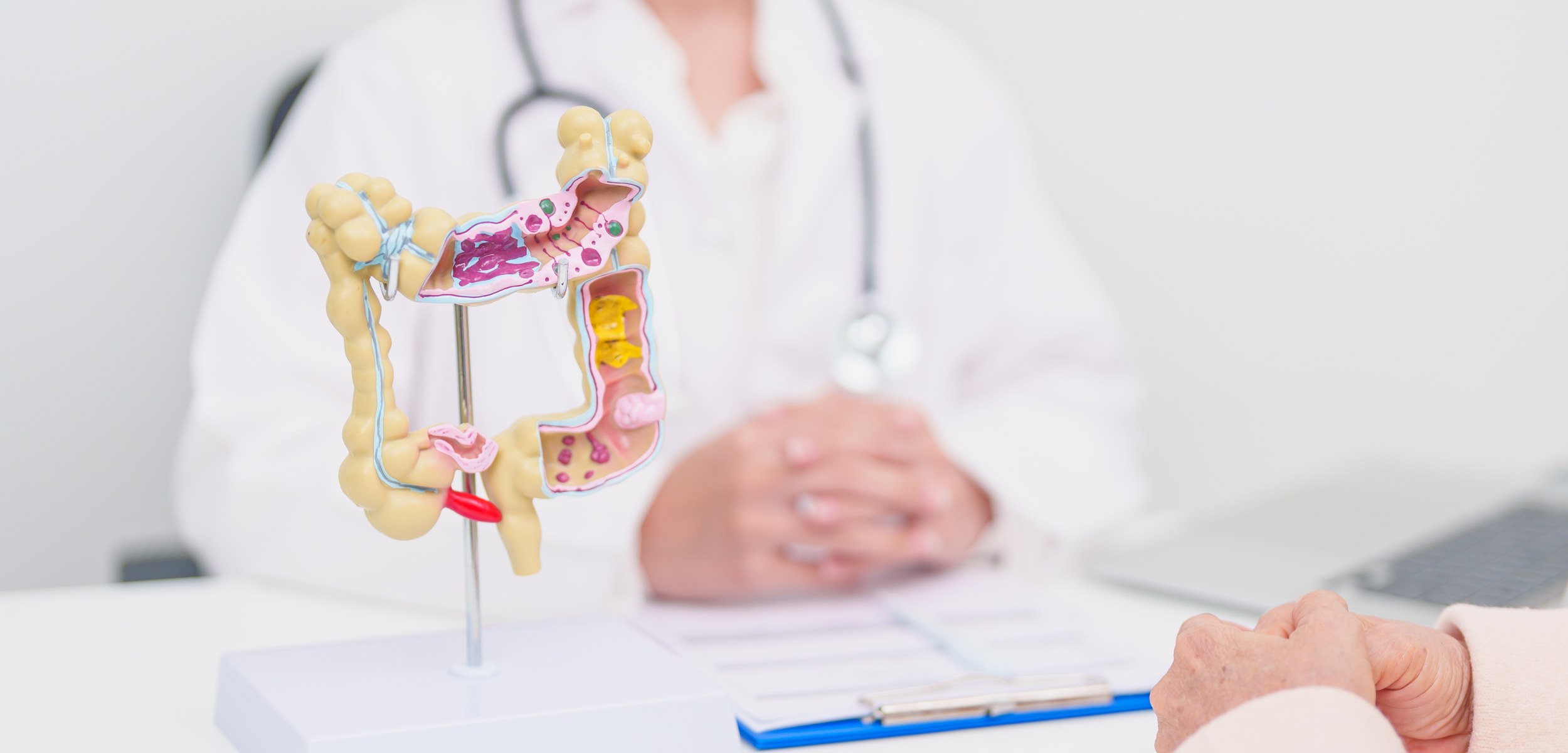 Hemorrhoids — Doctor with colon model consulting patient